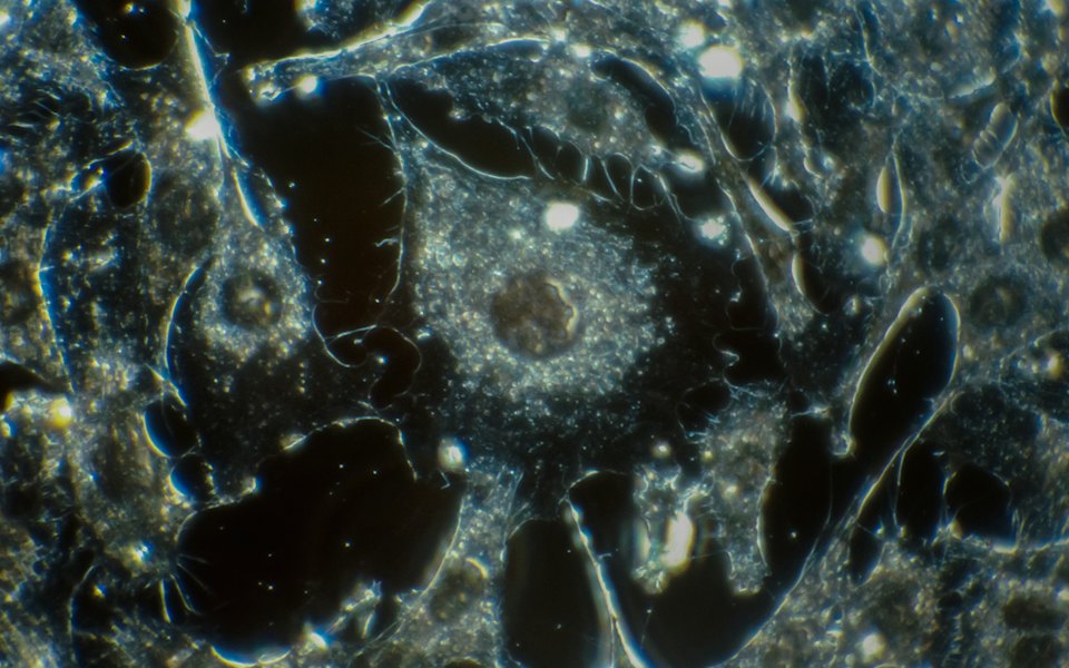 Cells seen under a dark-field microscope